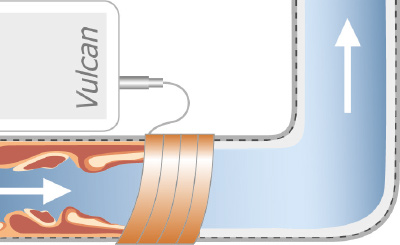 reduccion de oxido y cal en las tuberias con vulcan